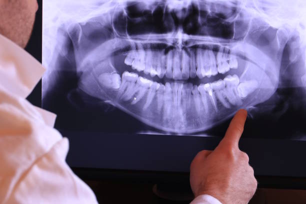 Best Holiday Emergency Dentist in Mason, TX