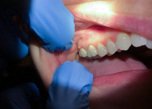 Best Broken or Cracked Tooth Emergency Dentist in Mason, TX